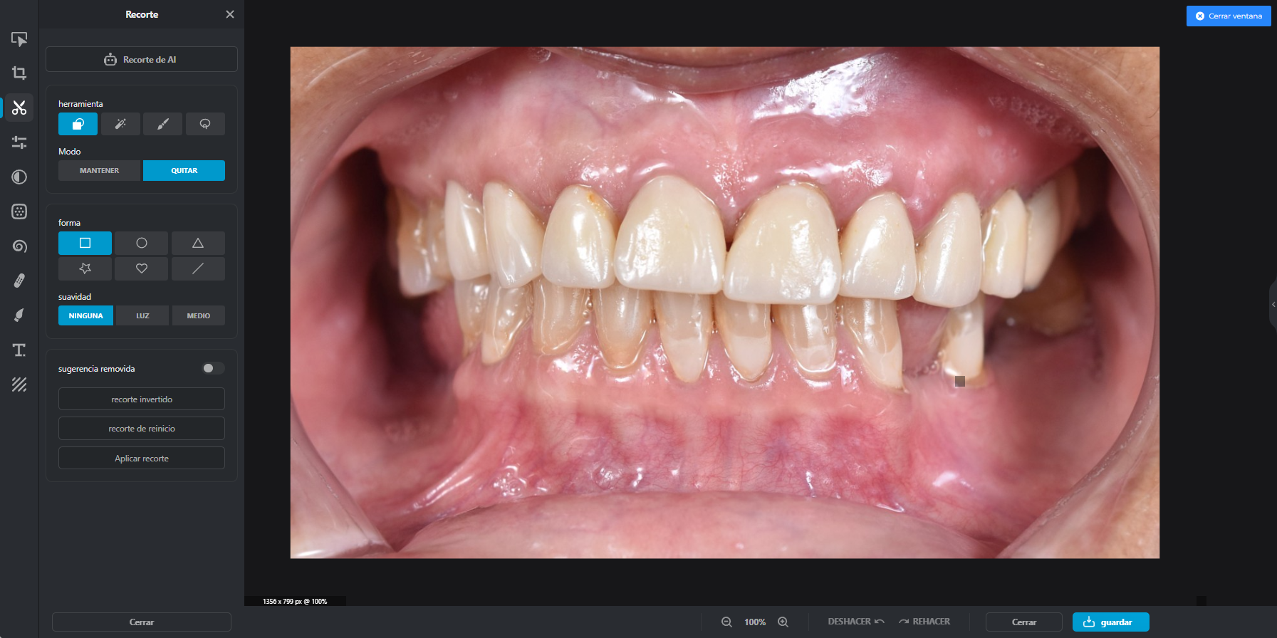 Odontograma y plan de tratamiento